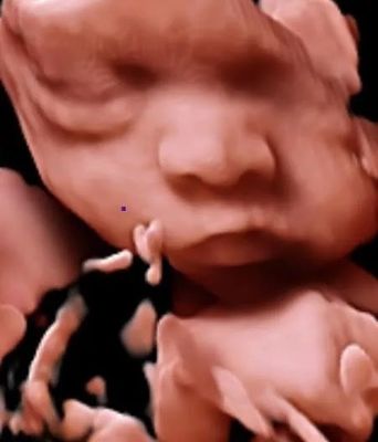 3D 4D 5D Color Doppler Ultrasonograf Wózek USG do OB GYN
